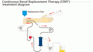 continuous renal replacement therapy