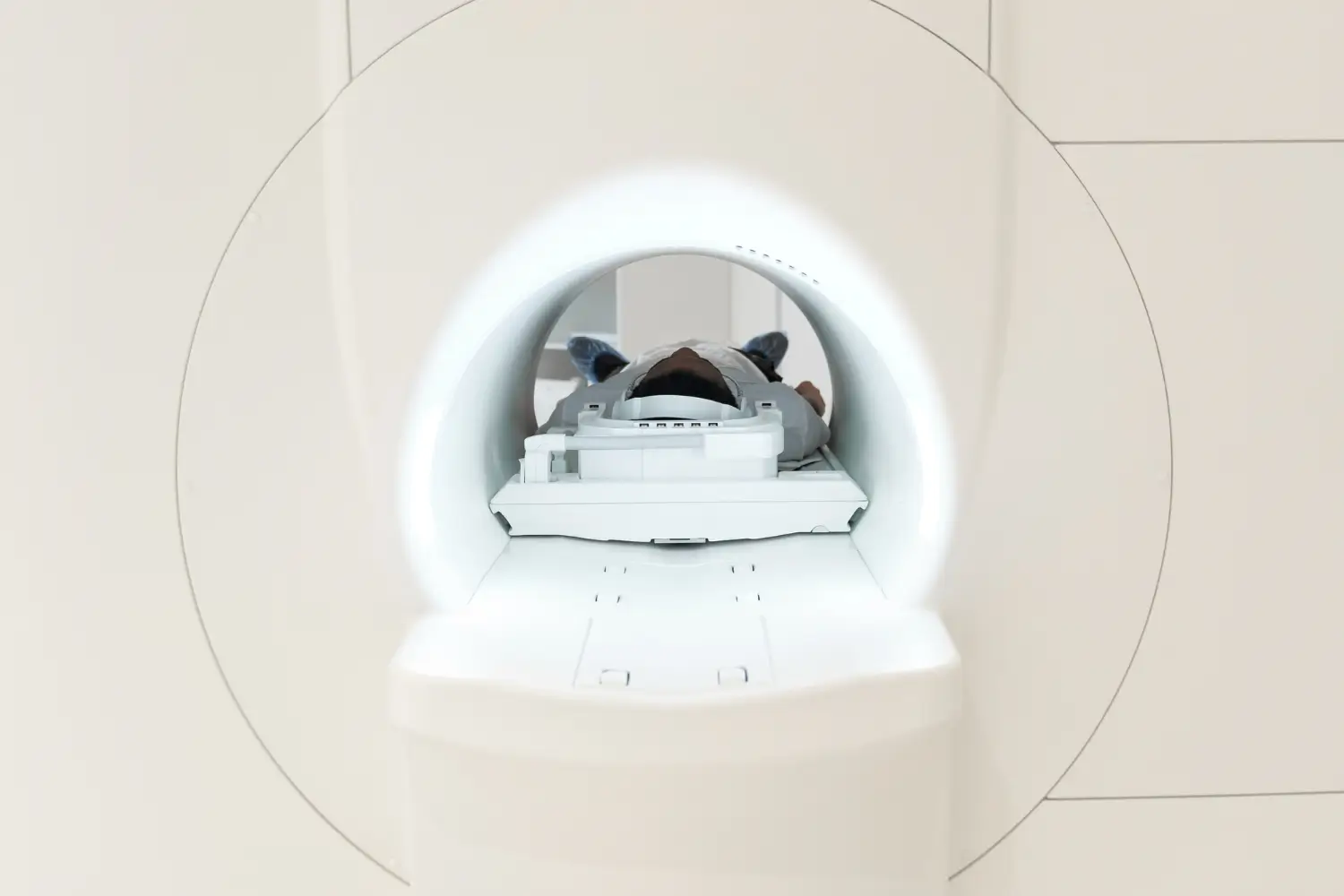 CT Scan (Computed Tomography)